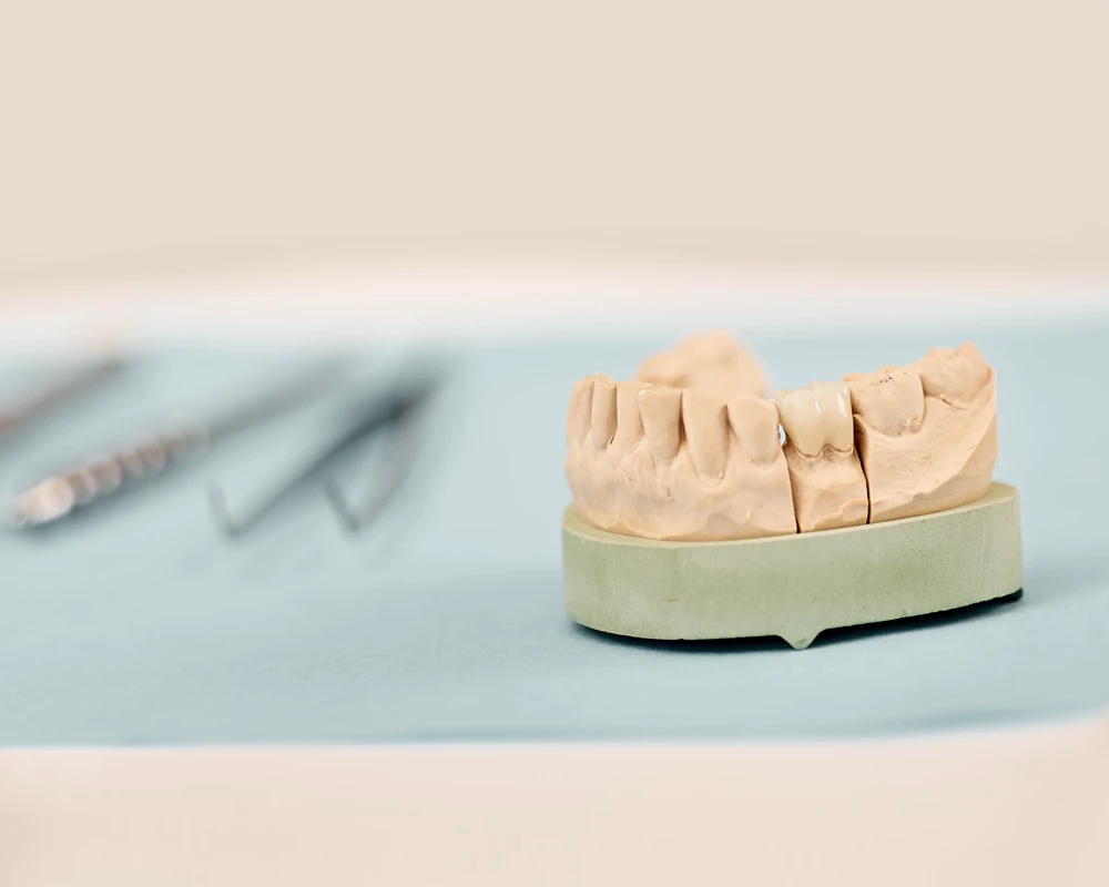 Zeitgemäße Versorgung mit Implantaten.